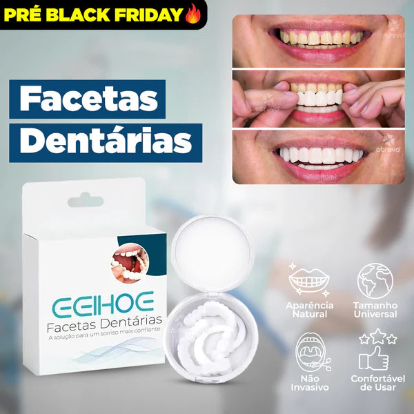 SmileFit® - Facetas Dentárias Naturais Removíveis