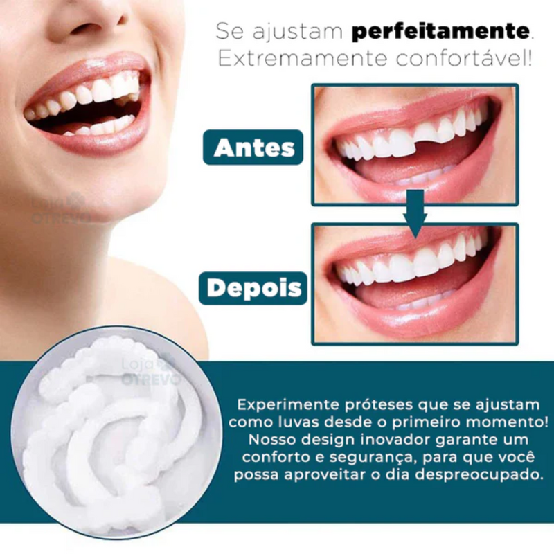 SmileFit® - Facetas Dentárias Naturais Removíveis